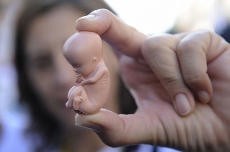 Qızların abortla məhvi - Hüquq müdafiəçisi çıxış yolu göstərdi