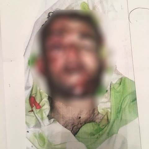 Bakı-Sumqayıt yolunda vurulan piyadanın (+18 FOTOSU)