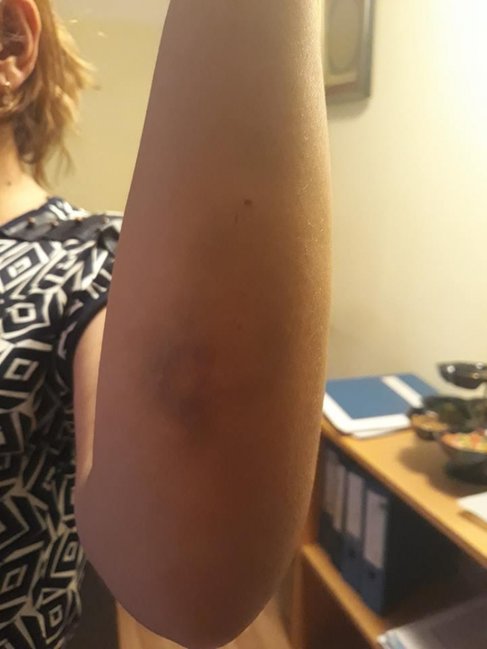 Bakıda DƏHŞƏT! Ər uşağının gözü qarşısında arvadını dəmir 