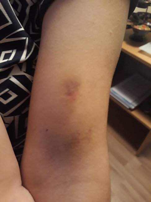 Bakıda DƏHŞƏT! Ər uşağının gözü qarşısında arvadını dəmir 