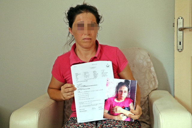 Qadın əri tərəfindən bu hala salındı – ŞOK SƏBƏB - FOTO