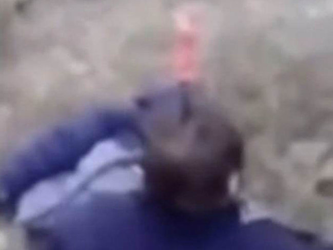 "Nəfəs ala bilmirəm" deyib bıçağı başına sapladı