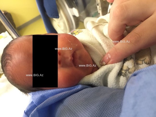 Həkim tərəfiindən öldürüldüyü deyilən körpənin ÜRƏKDAĞLAYAN GÖRÜNTÜLƏRİ YAYILDI - FOTOLAR