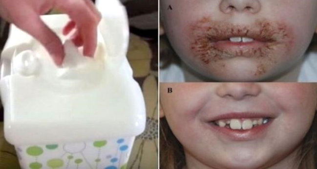 Uşaq yaş salfetdən istifadə etdi, ağzı bu hala düşdü - FOTO