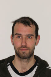 Hər gün qazlı su içən kişinin dişləri bu hala düşdü - FOTO