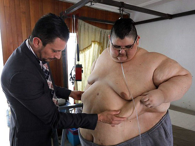 Ən kök adam 250 kq arıqladı - FOTO