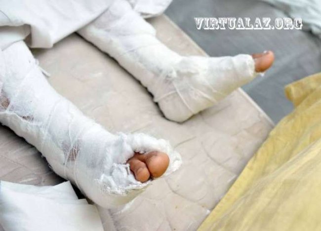 Polislərin döydüyü qadın özünü 3-cü mərtəbədən atdı: 