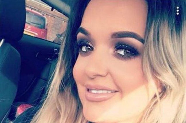 Dodağını şişirdən qadın: "Ördəyə oxşadım" - FOTO