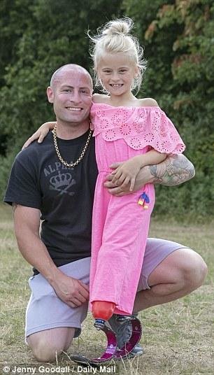 İki ayağı kəsilmiş 7 yaşlı qız model oldu - FOTOLAR