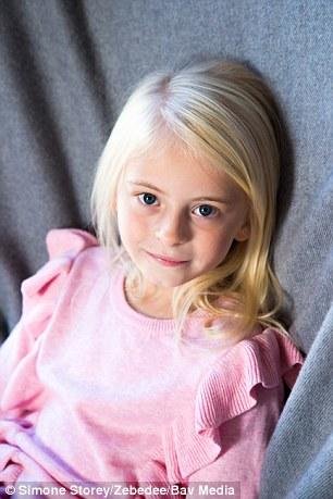 İki ayağı kəsilmiş 7 yaşlı qız model oldu - FOTOLAR