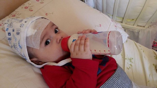 Balaca Alicanın xilası üçün 15 min manat lazımdır - FOTOLAR