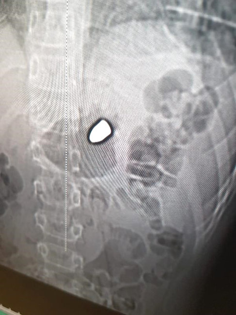 8 yaşlı uşağı ürəyindən güllələdilər - Nüfuzlu şəxsin oğlu imiş - FOTO