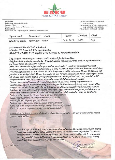 Balaca Alicanın xilası üçün 15 min manat lazımdır - FOTOLAR