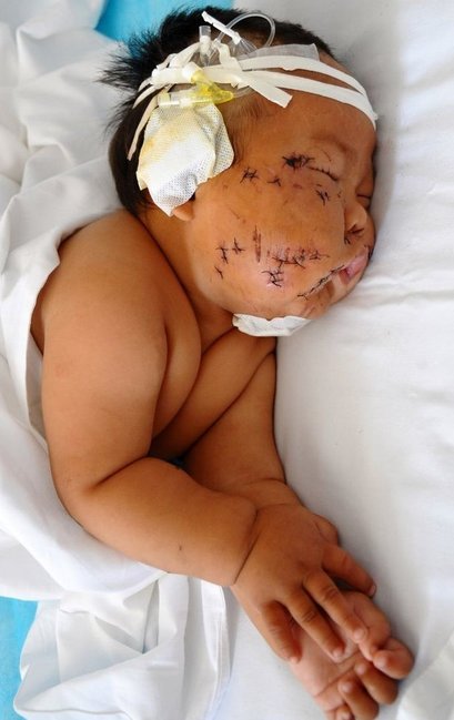 Ana övladına qida verən zaman üzünü qayçı ilə 90 dəfə kəsib