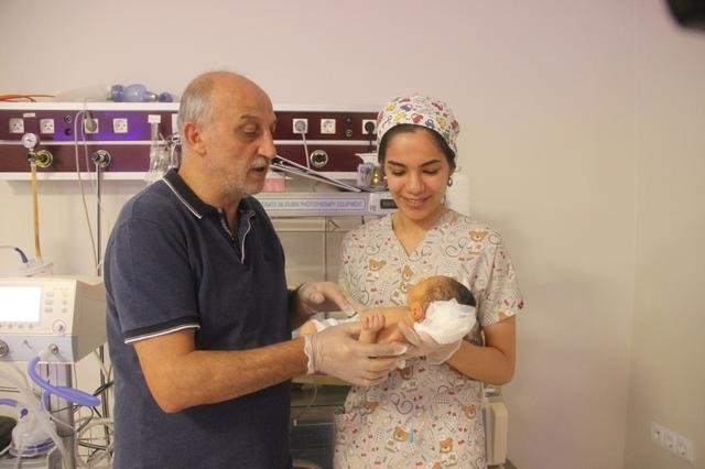 İki başlı uşaq dünyaya gəldi - FOTOLAR