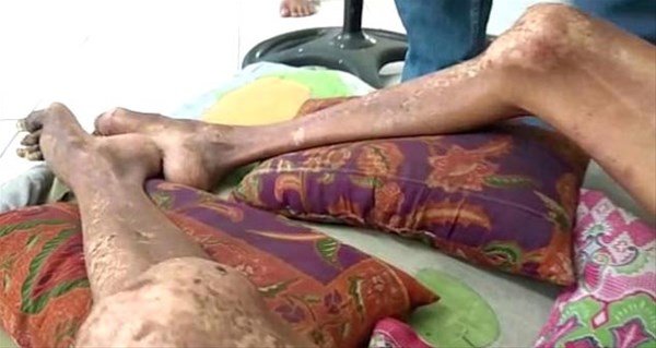 Qəza nəticəsində avtobusun pəncərəsindən 