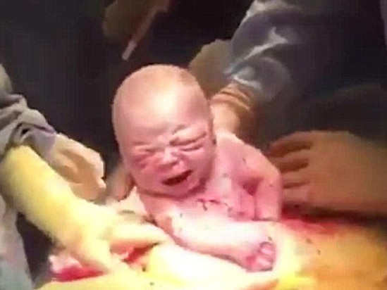 Ananın doğum anı ANBAAN KAMERADA - VİDEO+FOTOLAR