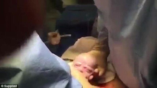 Ananın doğum anı ANBAAN KAMERADA - VİDEO+FOTOLAR