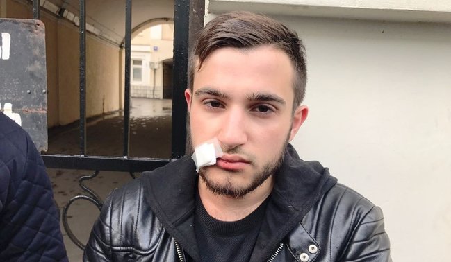 Moskvada ermənilərlə azərbaycanlılar arasında DAVA DÜŞDÜ - FOTOLAR