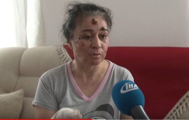 Bu qadın gün işığına çıxanda orqanlarını itirir – Video