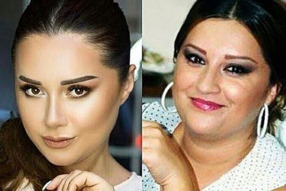 Xatirə İslamın estetik əməliyyatdan öncəki fotosu yayıldı