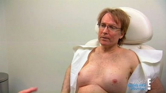 BİABIRÇILIQ! Kişi sinəsinə silikon vurdurub qadınla yatdı - FOTOLAR