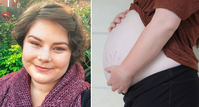 16 yaşlı qızın qarnı şişməyə başladı - Hamı hamilə olduğunu düşünsə də…/FOTO