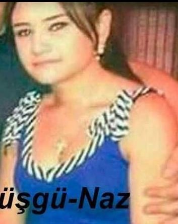 Bu da evlilik verişinin azərbaycanlı ulduzu Nazın əməliyyatsız FOTOSU