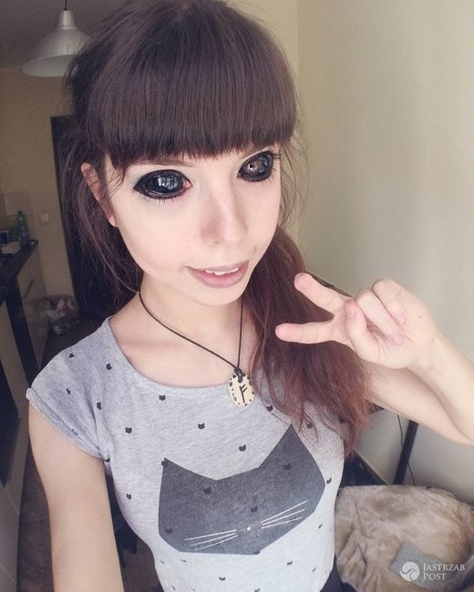 Gözlərinin içinə tatu vurduran gənc qız görmə qabiliyyətini itirdi - FOTOLAR