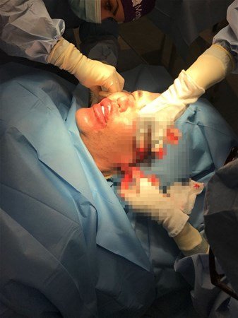 Oyuncağa bənzəmək üçün bıçaq altına yatdı - Əməliyyatdan şok görüntülər