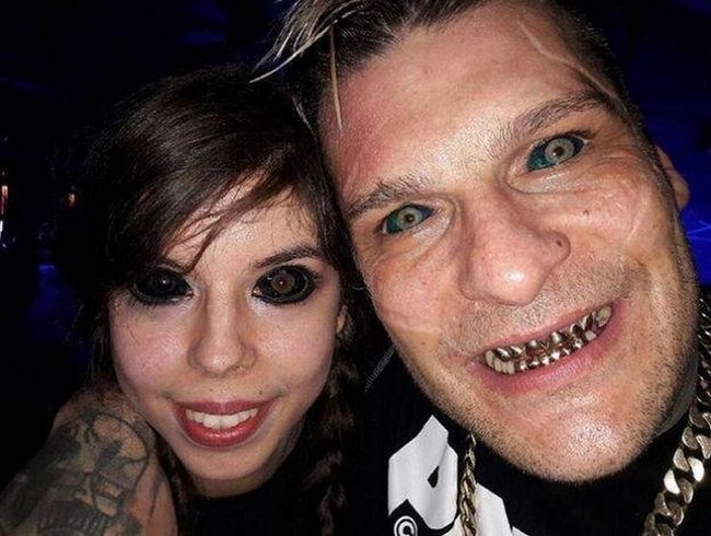 Gözlərinin içinə tatu vurduran gənc qız görmə qabiliyyətini itirdi - FOTOLAR