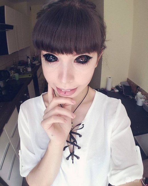 Gözlərinin içinə tatu vurduran gənc qız görmə qabiliyyətini itirdi - FOTOLAR