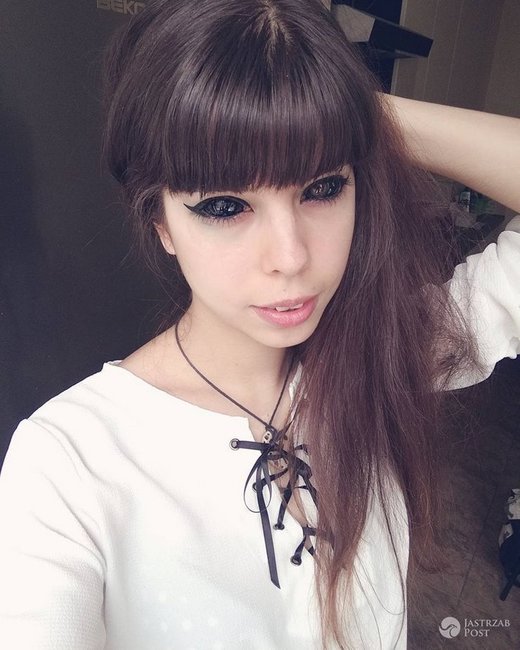 Gözlərinin içinə tatu vurduran gənc qız görmə qabiliyyətini itirdi - FOTOLAR