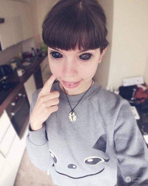 Gözlərinin içinə tatu vurduran gənc qız görmə qabiliyyətini itirdi - FOTOLAR