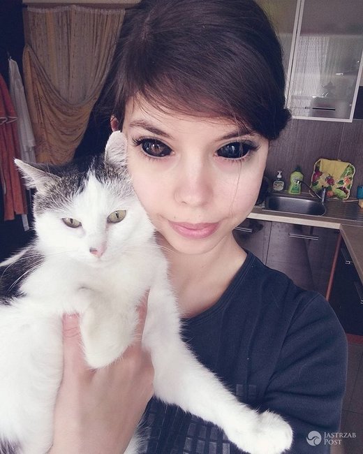 Gözlərinin içinə tatu vurduran gənc qız görmə qabiliyyətini itirdi - FOTOLAR