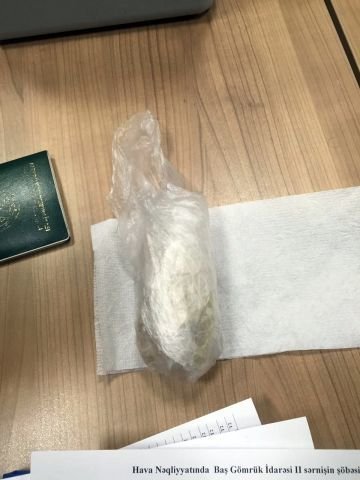 Gömrükdə RƏZALƏT: Qadının daxili orqanından elə şeylər tapdılar ki... - FOTOLAR