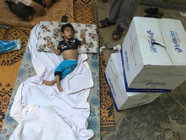 Ac qaldığına görə it-pişik əti yedi, infeksiyaya yoluxdu - Ürəkparçalayan FOTO