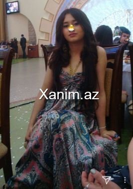 400 minlik toyu ilə gündəmə gələn məmurun qızının estetiksiz FOTOSU - Görənlər tanımadı