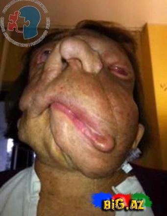 26 yaşlı qız yeni sifətə sahib oldu - FOTO