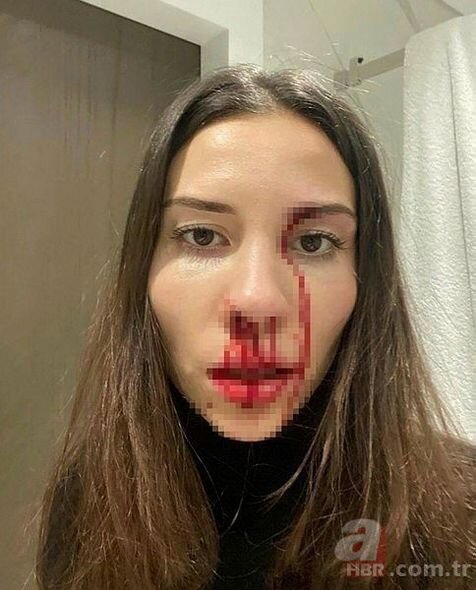 Daha bir qadına şiddət: Məşhur futbolçu arvadını övladlarının gözü qarşısında... - FOTO