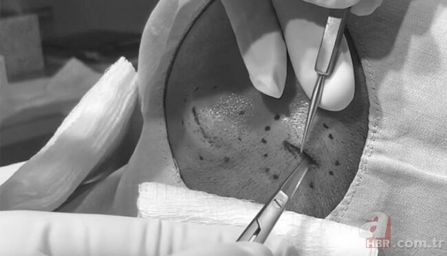 Başındakı şişə görə həkimə getdi, nəticədən şoka düşdü - FOTOLAR