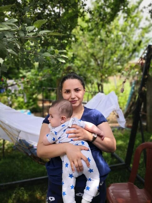 Azərbaycanlı məşhur doğuşdan sonra tanınmaz halda - FOTO