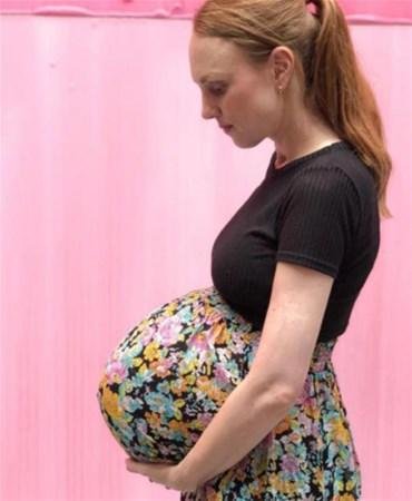 Qarnını görənlər inana bilmirlər - FOTOLAR