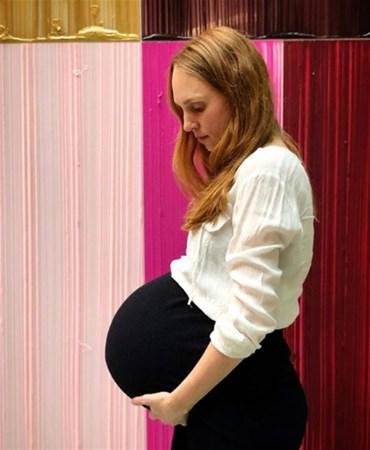 Qarnını görənlər inana bilmirlər - FOTOLAR