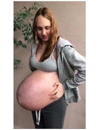 Qarnını görənlər inana bilmirlər - FOTOLAR