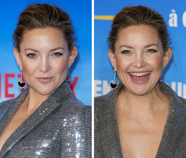 Təbəssüm etdikdə sanki başqa insana çevrilən 17 ULDUZ - FOTO