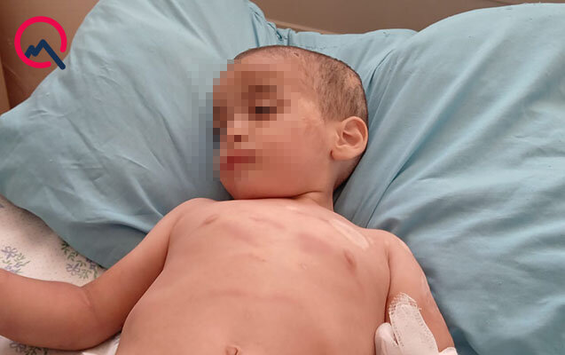 "Mənim əl-qolumu bağlamışdı"- Döyülən uşaqların anası - VİDEO+FOTO