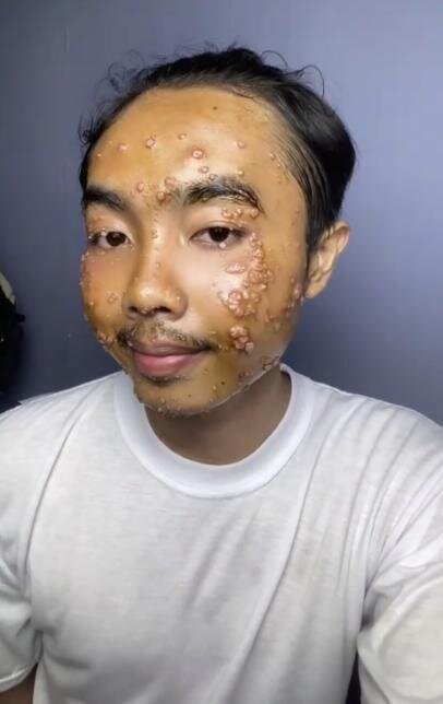 İkinci əl paltar aldı, dərisi bu günə düşdü - FOTO