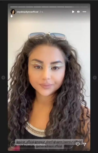 Tanınmış aktrisa plastik əməliyyatdan sonra - FOTO