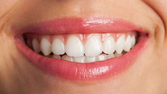 Dişlərin ağardılmasının ən yaxşı üsulları - VİDEO